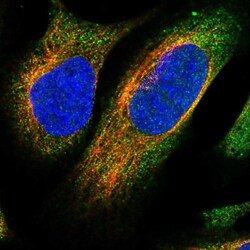 NCKAP1 Antibody, Novus Biologicals 0.1mL; Unlabeled:Antibodies, Polyclonal