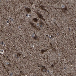 NCKAP1 Antibody, Novus Biologicals 0.1mL; Unlabeled:Antibodies, Polyclonal