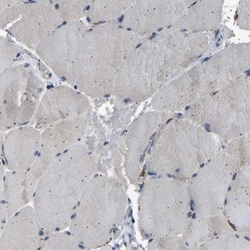 NCKAP1 Antibody, Novus Biologicals 0.1mL; Unlabeled:Antibodies, Polyclonal