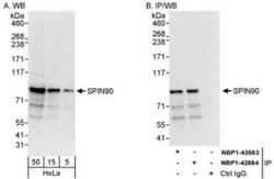 NCKIPSD Antibody, Novus Biologicals 0.1mL; Unlabeled:Antibodies, Polyclonal