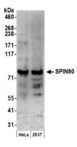 NCKIPSD Antibody, Novus Biologicals 0.1mL; Unlabeled:Antibodies, Polyclonal