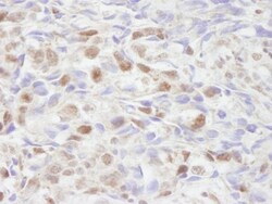 NCOA2 Antibody, Novus Biologicals 0.1mL; Unlabeled:Antibodies, Polyclonal