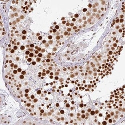 NCOA5 Antibody, Novus Biologicals 25 &mu;L; Unlabeled:Antibodies, Polyclonal