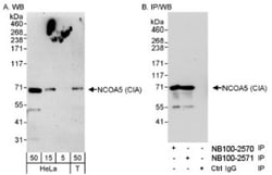 NCOA5 Antibody, Novus Biologicals 0.1mL; Unlabeled:Antibodies, Polyclonal