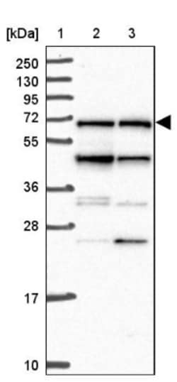 NCOA5 Antibody, Novus Biologicals 25 &mu;L; Unlabeled:Antibodies, Polyclonal