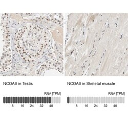 NCOA6 Antibody, Novus Biologicals:Antibodies:Primary Antibodies