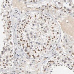 NCOA6 Antibody, Novus Biologicals:Antibodies:Primary Antibodies