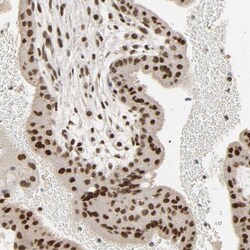 NCOA6 Antibody, Novus Biologicals:Antibodies:Primary Antibodies