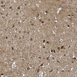 NCOA7 Antibody, Novus Biologicals 25 &mu;L; Unlabeled:Antibodies, Polyclonal