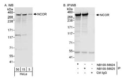 NCOR1 Antibody, Novus Biologicals 0.1 mL | Buy Online | Novus Biologicals | Fisher Scientific