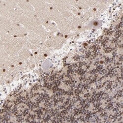NCOR2 Antibody, Novus Biologicals 0.1mL; Unlabeled:Antibodies, Polyclonal