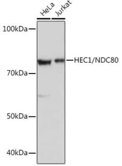 NDC80 Rabbit anti-Human, Clone: 4W2Y2, Novus Biologicals 20 &mu;g; Unconjugated:Antibodies,