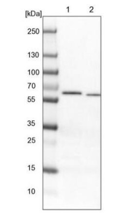 NDOR1 Antibody, Novus Biologicals 0.1 mL | Buy Online | Novus Biologicals | Fisher Scientific