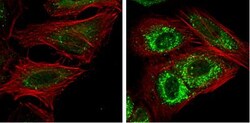 NDP52 Antibody, Novus Biologicals 0.1mL; Unlabeled:Antibodies, Polyclonal