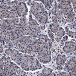 NDP52 Antibody, Novus Biologicals 25 &mu;L; Unlabeled:Antibodies, Polyclonal