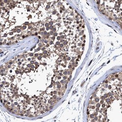 NDP52 Antibody, Novus Biologicals 25 &mu;L; Unlabeled:Antibodies, Polyclonal