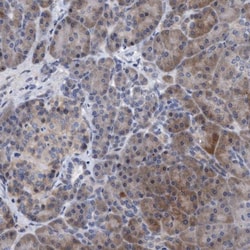 NDP52 Antibody, Novus Biologicals 25 &mu;L; Unlabeled:Antibodies, Polyclonal