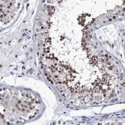 NDP52 Antibody, Novus Biologicals 25 &mu;L; Unlabeled:Antibodies, Polyclonal