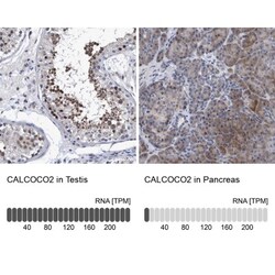 NDP52 Antibody, Novus Biologicals 25 &mu;L; Unlabeled:Antibodies, Polyclonal