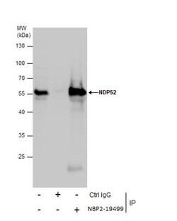 NDP52 Antibody, Novus Biologicals 0.1mL; Unlabeled:Antibodies, Polyclonal