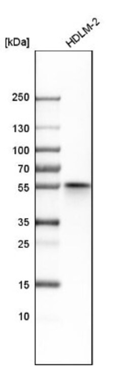 NDP52 Antibody, Novus Biologicals 25 &mu;L; Unlabeled:Antibodies, Polyclonal