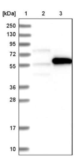 NDP52 Antibody, Novus Biologicals 25 &mu;L; Unlabeled:Antibodies, Polyclonal