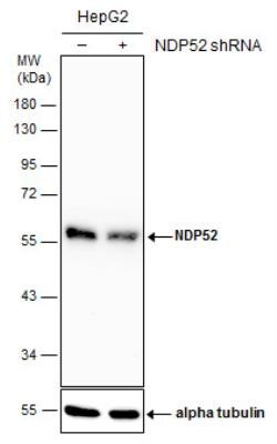 NDP52 Antibody, Novus Biologicals 0.1mL; Unlabeled:Antibodies, Polyclonal