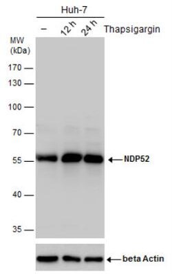 NDP52 Antibody, Novus Biologicals 0.1mL; Unlabeled:Antibodies, Polyclonal