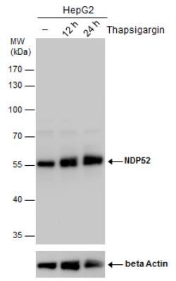 NDP52 Antibody, Novus Biologicals 0.1mL; Unlabeled:Antibodies, Polyclonal