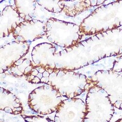 NDRG1 Rabbit anti-Human, Mouse, Rat, Clone: 2C6K6, Novus Biologicals:Antibodies:Primary