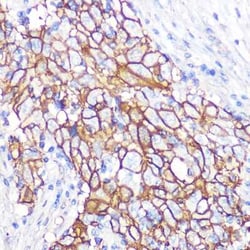 NDRG1 Rabbit anti-Human, Mouse, Rat, Clone: 2C6K6, Novus Biologicals:Antibodies:Primary
