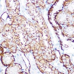 NDRG1 Rabbit anti-Human, Mouse, Rat, Clone: 2C6K6, Novus Biologicals:Antibodies:Primary