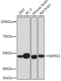 NDRG1 Rabbit anti-Human, Mouse, Rat, Clone: 2C6K6, Novus Biologicals:Antibodies:Primary