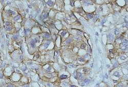 NDRG1 Antibody, Novus Biologicals 0.1mg; Unlabeled:Antibodies, Polyclonal