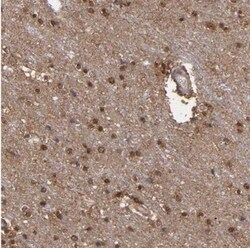 NDRG2 Antibody, Novus Biologicals 25ul | Buy Online | Novus Biologicals | Fisher Scientific