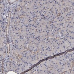 NDRG2 Antibody, Novus Biologicals 25ul | Buy Online | Novus Biologicals | Fisher Scientific