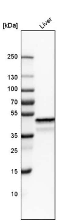 NDRG2 Antibody, Novus Biologicals 25ul | Buy Online | Novus Biologicals | Fisher Scientific