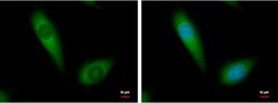 NDUFA10 Antibody, Novus Biologicals 0.1mL; Unlabeled:Antibodies, Polyclonal