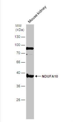 NDUFA10 Antibody, Novus Biologicals 0.1mL; Unlabeled:Antibodies, Polyclonal