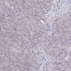 NDUFA7 Antibody, Novus Biologicals 25 &mu;L | Buy Online | Novus Biologicals | Fisher Scientific