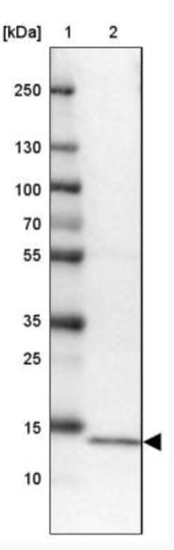 NDUFA7 Antibody, Novus Biologicals 25 &mu;L | Buy Online | Novus Biologicals | Fisher Scientific