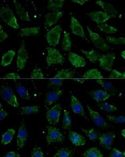 NDUFB1 Rabbit anti-Human, Mouse, Polyclonal, Novus Biologicals 20 &mu;g | Buy Online | Bio-Techne | Fisher Scientific