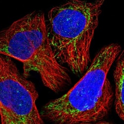 NDUFB11 Antibody, Novus Biologicals:Antibodies:Primary Antibodies