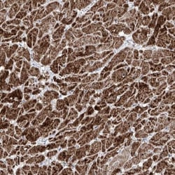 NDUFB3 Antibody, Novus Biologicals 25 &mu;L | Buy Online | Novus Biologicals | Fisher Scientific