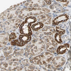 NDUFB5 Antibody, Novus Biologicals:Antibodies:Primary Antibodies