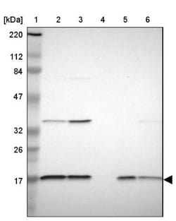 NDUFB5 Antibody, Novus Biologicals:Antibodies:Primary Antibodies