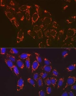 NDUFB8 Rabbit anti-Human, Mouse, Rat, Clone: 6T8G1, Novus Biologicals 100