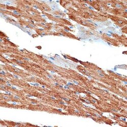 NDUFB8 Rabbit anti-Human, Mouse, Rat, Clone: 6T8G1, Novus Biologicals 100