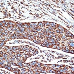 NDUFB8 Rabbit anti-Human, Mouse, Rat, Clone: 6T8G1, Novus Biologicals 100
