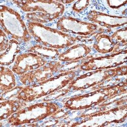 NDUFB8 Rabbit anti-Human, Mouse, Rat, Clone: 6T8G1, Novus Biologicals 100